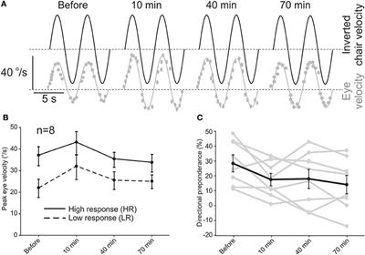 Rebalancing the Vestibular System by Unidirectional Rotations in Patients With Chronic Vestibular Dysfunction